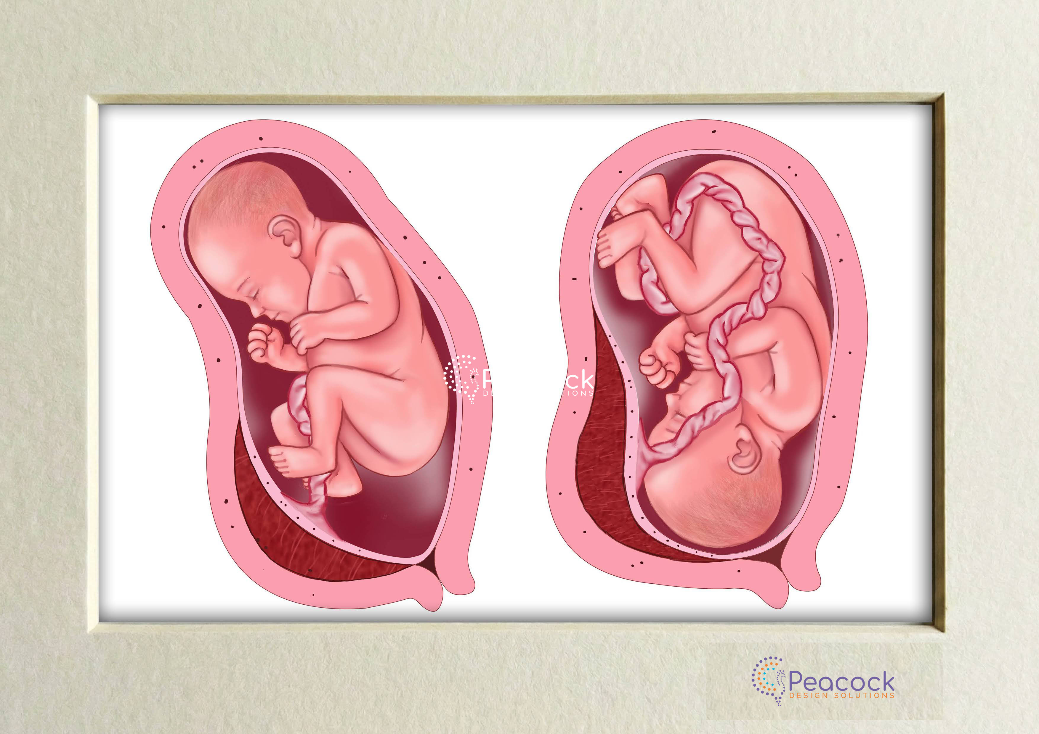 Fetal Positions